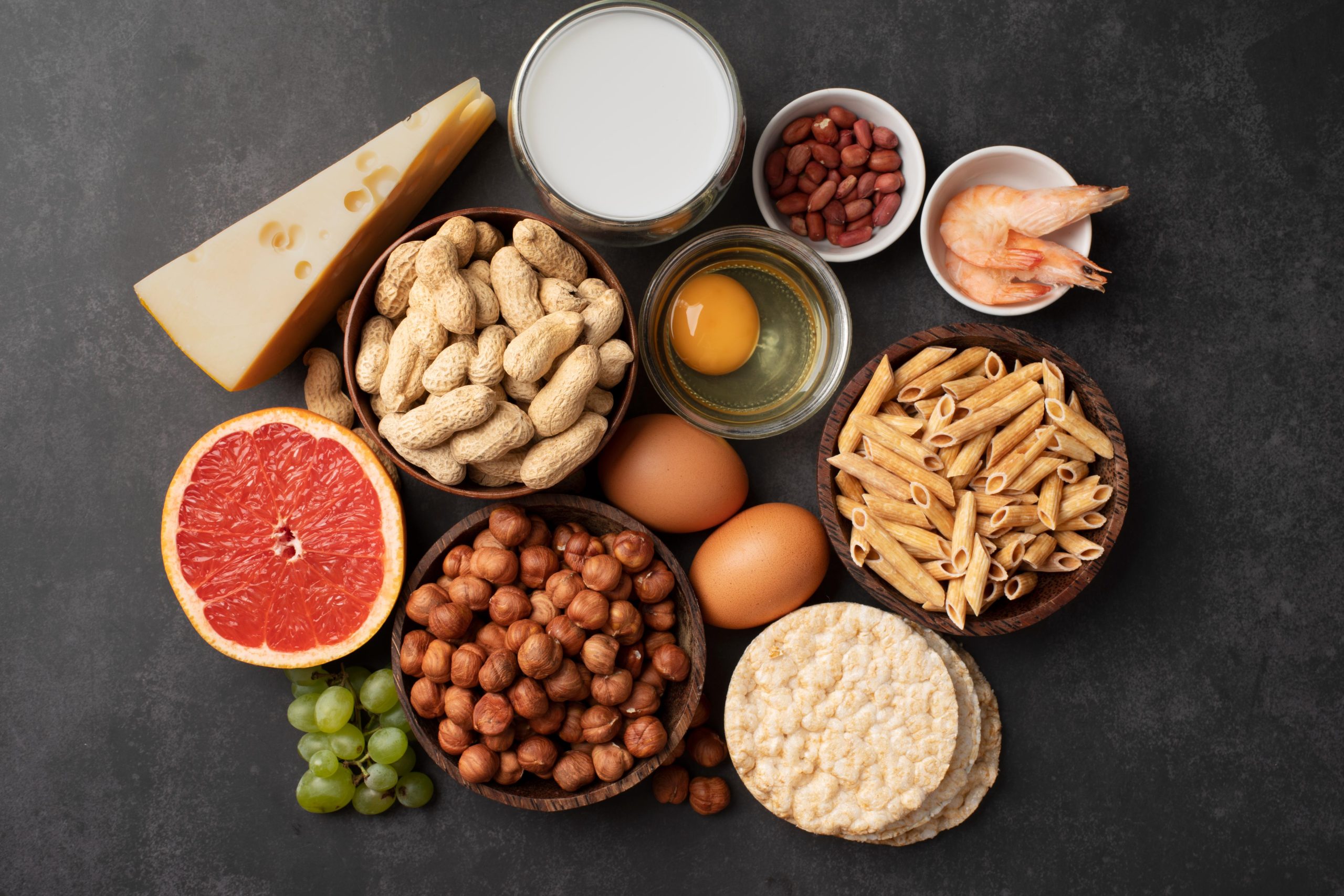 Dairy free, gluten free, nut free, fish and shellfish allergies catered for if informed in advance